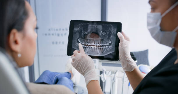 Licensed Root Canal Treatment service in Carson, CA - Smile Center Dentistry